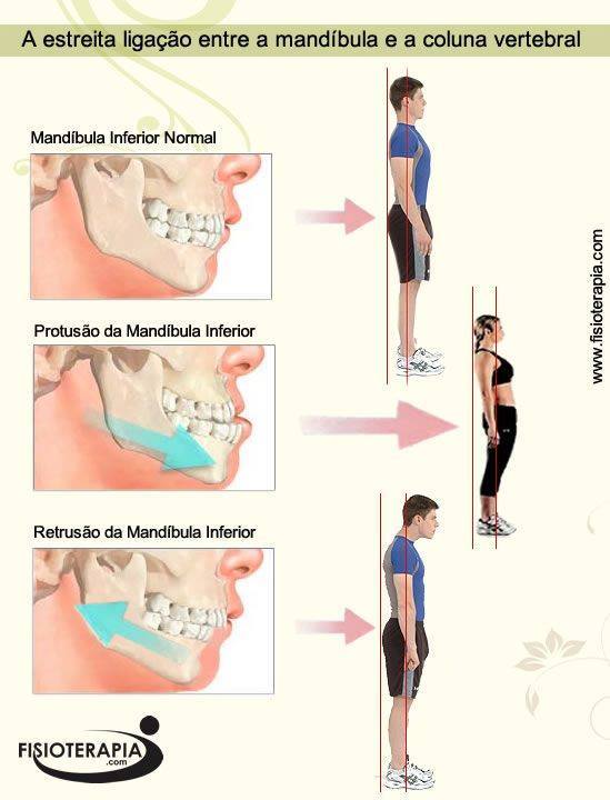 Problemas na mandíbula podem ser responsáveis por disfunções no organismo